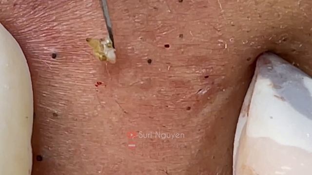 Satisfying and Relaxation with SURI NGUYEN Beauty Spa Video #478