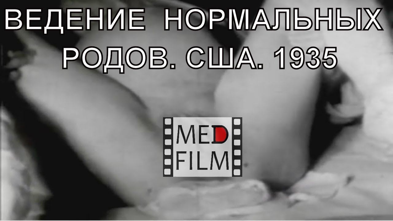 Normal childbirth, USA, 1935 © Нормальные роды, США, 1935
