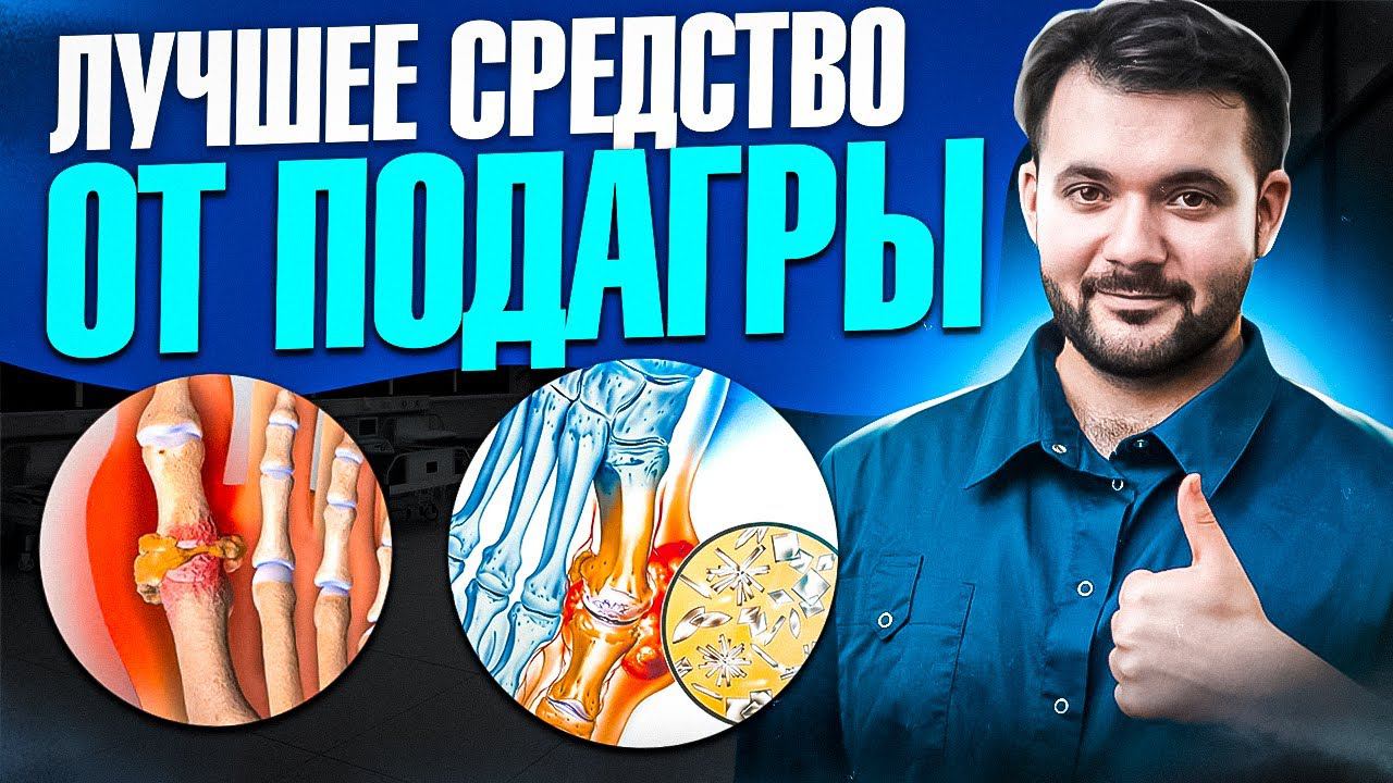 ЗАБУДЬ О ПОДАГРЕ НАВСЕГДА! Лучший способ избавиться от проблемы